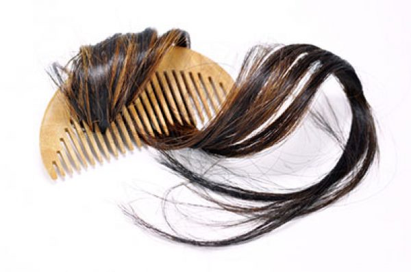 Traitement de la perte des cheveux - Dr Magnier à Charenton